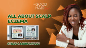All about Scalp Eczema