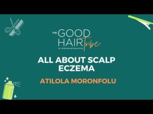 All about Scalp Eczema